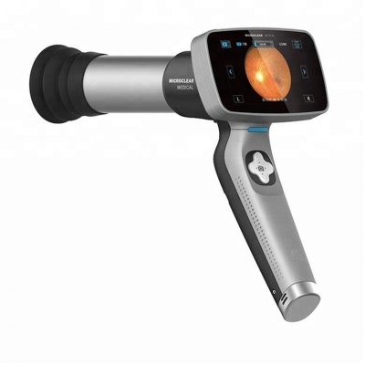 Digital Non-mydryatic Handheld Retina Camera